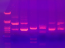 the result: dna sorted by length (dna-strands of different length move at different speeds)