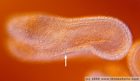 animation: globular embryo (arrow) in an ovule of capsella bursa-pastoris. differencial interference contrast microscopy and herr-prepared specimen animation: globular embryo (arrow) in an ovule of capsella bursa-pastoris. differencial interference contrast microscopy and herr-prepared specimen