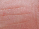 fingergelenk, innenseite, 100% ausschnitt || foto details: 2005-04-16, rum, austria, Sony Cybershot DSC-F717.