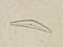 cymbella sp., a diatom alga. 2006-10-25, Sony Cybershot DSC-P93. keywords: chromista, heterokontophyta, stramenopila, bacillariophyta, bacillariophyceae, pennales, raphidineae, naviculaceae