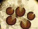 little pacmen throwing up: cleistothecia of microsphaera sp. were broken to show the asci. 2006-11-22, Sony Cybershot DSC-P93. keywords: ascomycota, leotiomycetes, erysiphales, erisyphales, erysiphaceae, erisyphaceae, fruiting body, fruit-body, fruit-bodies, cleitothecium