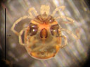 sperchon sp., a freshwater mite (hydrachnidia), ventral