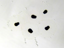 frogspawn development, day 2