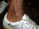 tiger leech (haemadipsa picta) on our guide's ankle. 2008-08-31, Sony F828.