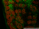 animation: part of a leaf through a confocal laser scanning microscope. green structures: parts of the cell wall, here especially epidermal cells. red structures: chloroplasts