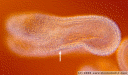 animation: globulärer embryo (pfeil) in einer samenanlage von capsella bursa-pastoris. differenzialinterferenzkontrast-mikroskopie und herr-präparat || foto details: 2009-04-02, innsbruck, austria, . keywords: differenzielle interferenzkonstrast-mikroskopie