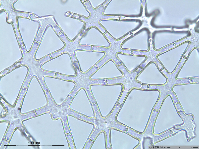 stellate parenchyma (aerenchyma) of juncus sp.